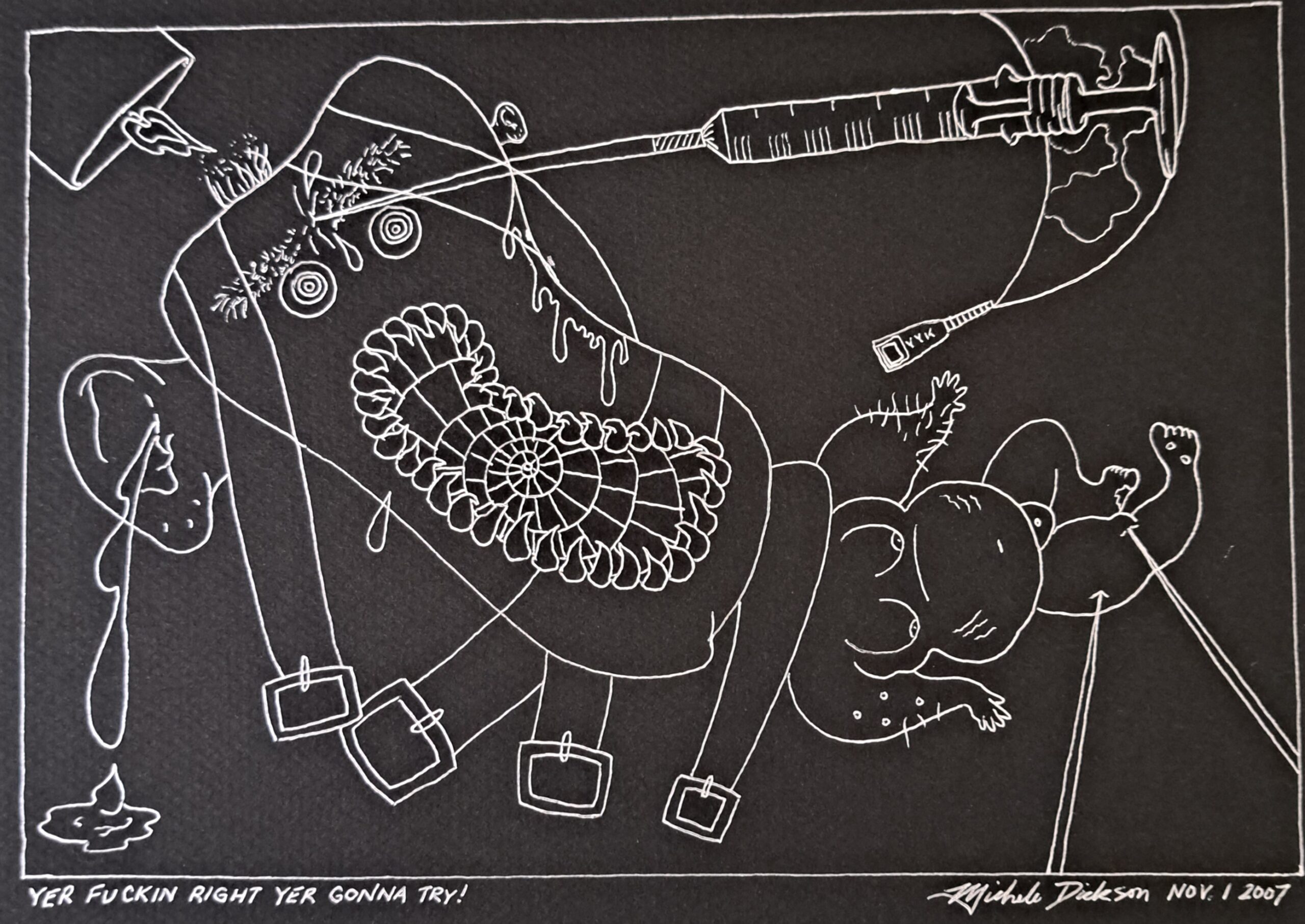 Drawing on black paper in white of an abstracted body and medical devices.